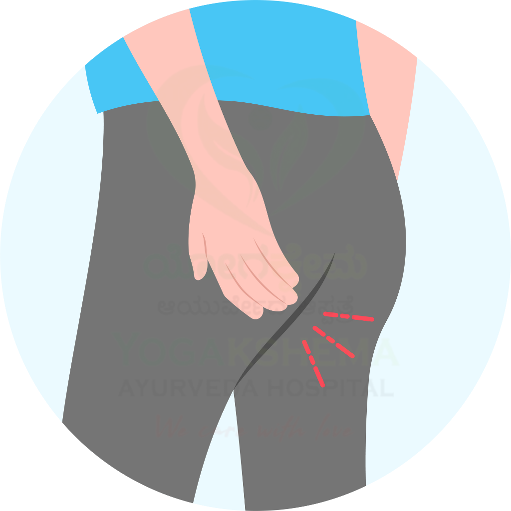 Anal Fistula