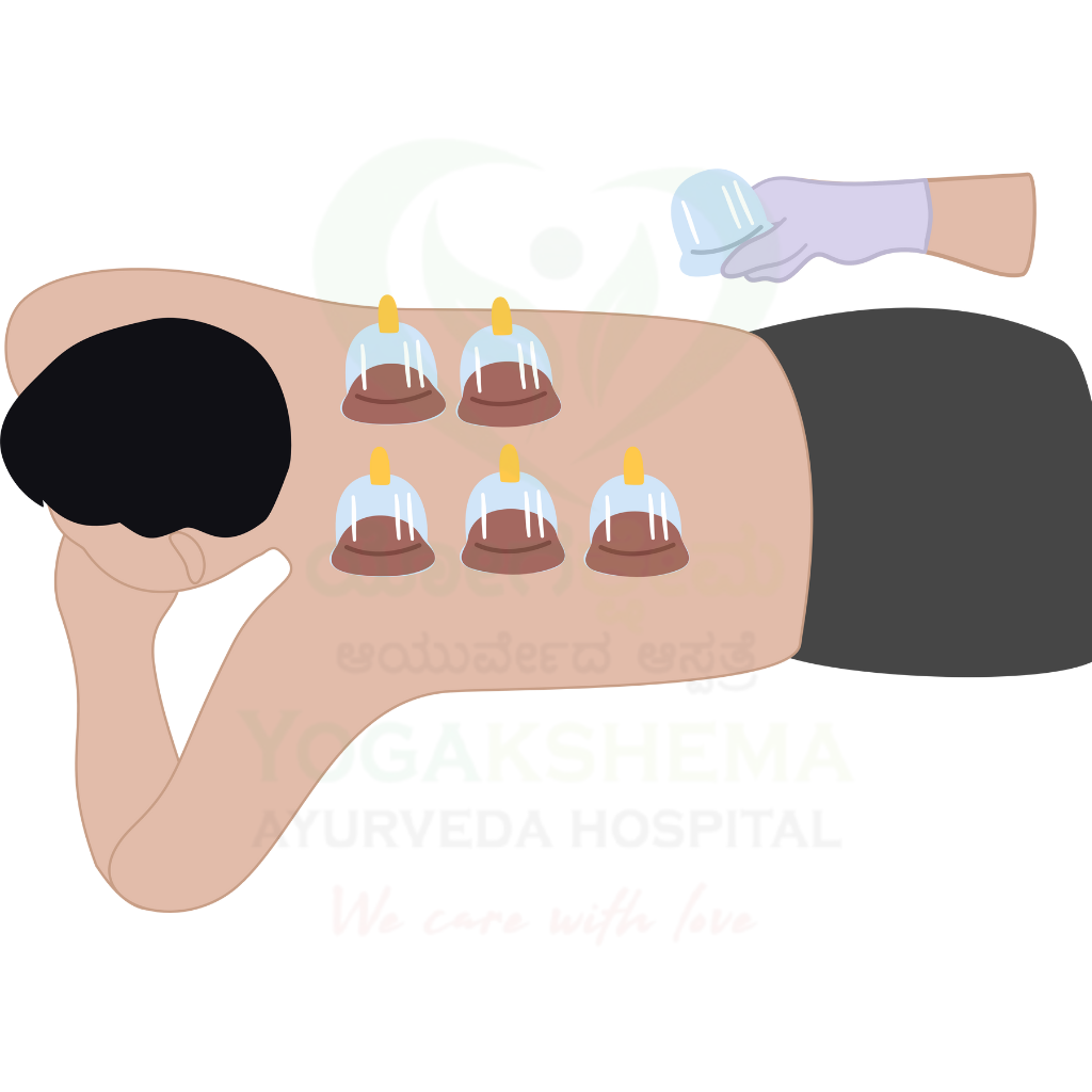 Wet-Cupping
