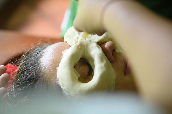 netra-tarpana-therapy-Yogakshema Ayurveda Hospital, Kushalnagar-One-of-the-best-Trusted-Hospital-Karanataka